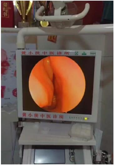 礼赞新中国 奋进新时代 中医鼻炎克星 慢病防治专家黄小侠