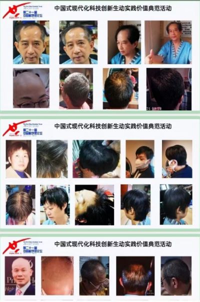 逐梦新时代 奋进新征程 新春特别报道生物科技创新科学家---刘蔓榕