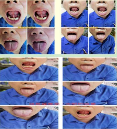 2024新春献礼专题报道 著名瑶医银疗推拿专家——周继辉