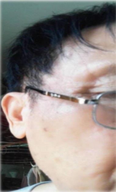 记量子氢氧健康第一人 长寿哥（廖永贵）