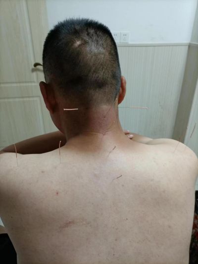 中国中医走向世界———方益初