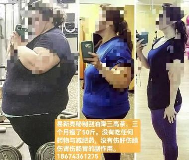 易新亮灵氧细胞针灸：开创百病断根快如闪电的创新疗法深度剖析！