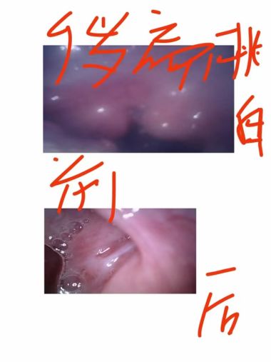 易新亮灵氧细胞针灸：开创百病断根快如闪电的创新疗法深度剖析！