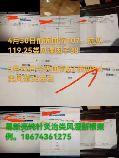 易新亮灵氧细胞针灸：开创百病断根快如闪电的创新疗法深度剖析！