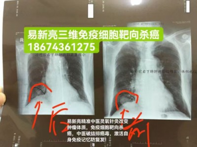 湘水易医易新亮靶向针灸断根疗法：道医智慧与现代科技的融合探索