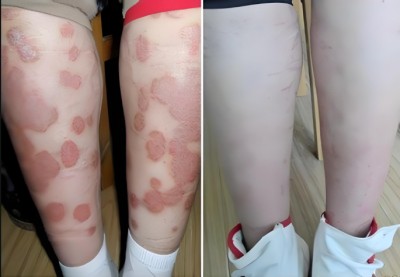 五十载岐黄坚守 研治援救显担当 传统医学专家牛富立事迹掠影