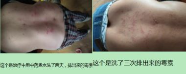 大医精诚 仁德为先 访著名中医专家---蔡培生