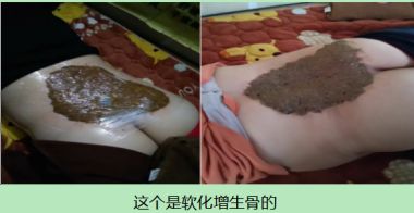 大医精诚 仁德为先 访著名中医专家---蔡培生