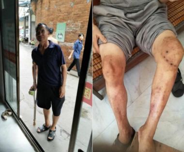 大医精诚 仁德为先 访著名中医专家---蔡培生