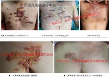 中国著名整形美容专家——蔡景龙