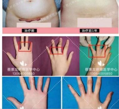 中国著名整形美容专家——蔡景龙