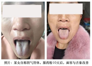 恭贺陈国林荣获“国医泰斗”荣誉称号