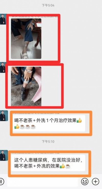 两会聚焦：特效醫術傅承人——黄良强